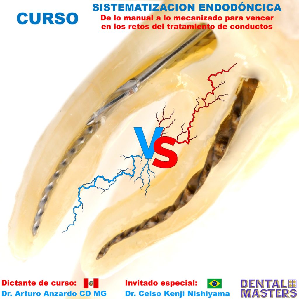 sistematizacion-endodoncica